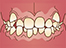 orthodontics033